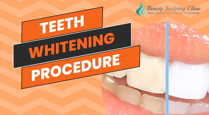 Teeth Whitening Procedure