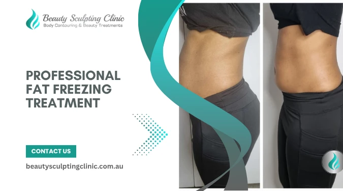 PROFESSIONAL Fat Freezing Treatment